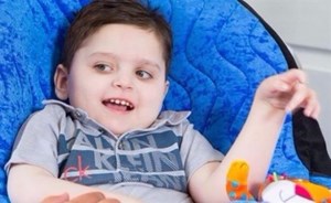 طفل يستعيد ابتسامته التي فقدها بسبب مرض نادر