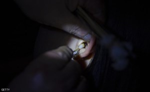 سبب “لا يصدق” للإصابة بآلام في الرأس