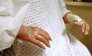 شركة أمريكية تستعد لتجربة تجديد جلد وشعر الإنسان