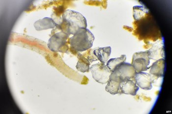 ملايين الديدان البحرية بديلا للدم البشري