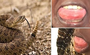 واقعة نادرة .. حيّة سامة تلدغ فتاة في فمها “لم تمت ووقع لها ما هو أغرب”