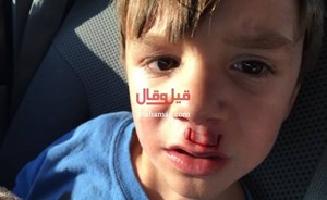 ضحية جديدة للعبة سبينر… ما فعله بها هذا الأب أودى بطفله إلى المستشفى