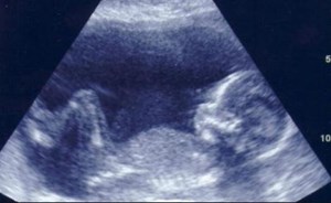 من المسؤول عن تحديد جنس الجنين؟؟ الرجل أم المرأة؟