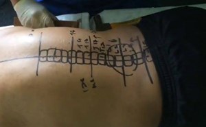 بالفيديو .. هجوم على معالج ماليزي يقوّم العظام بـ”المطرقة”