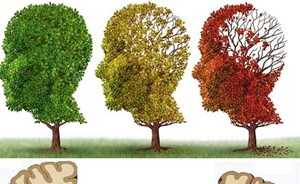 أهمها التعليم والسمع.. 9 عوامل تُجَنّبك الإصابة بالخرف