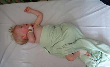 مؤثر.. رضيع تبتر قدمه بعد أن مشى أولى خطواته