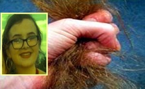 مراهقة أكلت شعر رأسها حتى الموت