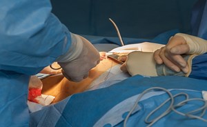 أطباء يكشفون حقيقة صادمة بعد فحص رئة أحد المرضى