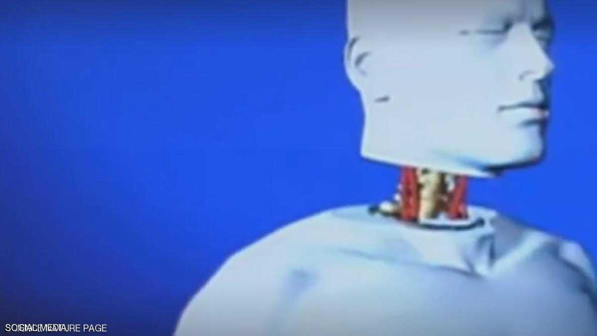 تغيير كبير في أول عملية زراعة رأس بالعالم