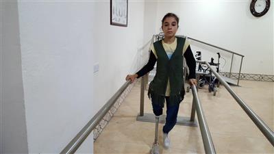 حملة الكويت لتركيب أطراف صناعية لـ 180 مصابًا بالموصل.. مستمرة