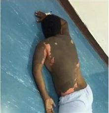 القبض على «حارقة زوجها بالزيت المغلي» في السعودية