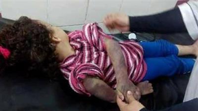 مأساة تهز القلوب.. طفلة مصرية عذبها والدها حتى الموت!