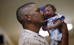 اكتشاف سبب التشوهات الخلقية الناجمة عن زيكا