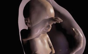 العثور على جنين ميت في بطن شقيقه التوأم المراهق: كيف حصلت المأساة؟