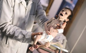 سوء التغذية يقتل رضيعين خلال يومين في الغوطة المحاصرة