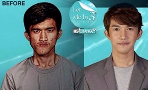 شاهد..خضع لعملية تجميل.. فلم تتعرف أمه عليه