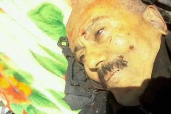 طبيب شرعي يمني يكشف تفاصيل مثيرة عن كيفية اغتيال #علي_عبدالله_صالح