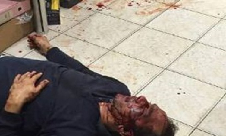التفاصيل الكاملة لحادث اعتداء مواطن على مصري في الشويخ الصناعية