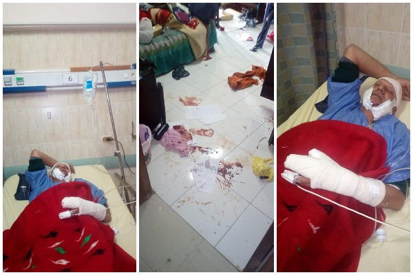 نجاة #مخرج_مصري من الموت.. مجهولون اقتحموا فيلته وسرقوا محتوياتها