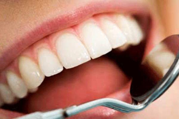 احذر.. 10 أطعمة تتلف أسنانك وتسبب التسوس