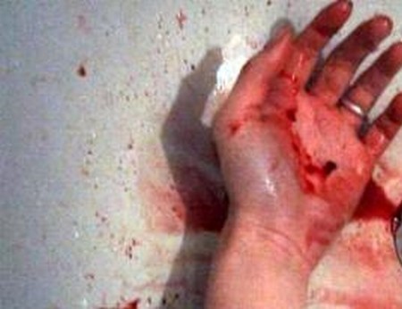 إنقاذ وافد من موت محقق بـ “النظارة”