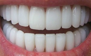 العلم يصل إلى طريقة تحفّز الأسنان للنمو من جديد!