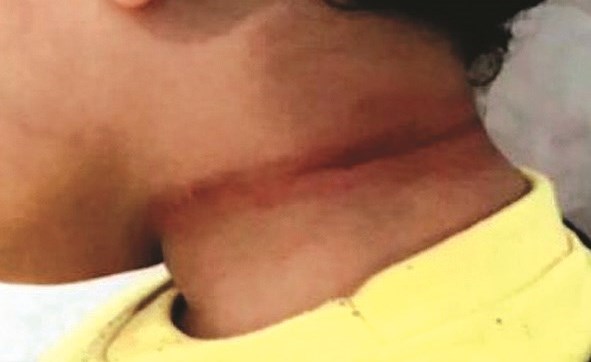 طالب يخنق زميله في «مبارك الكبير».. و«المنطقة» فتحت تحقيقاً في الحادث