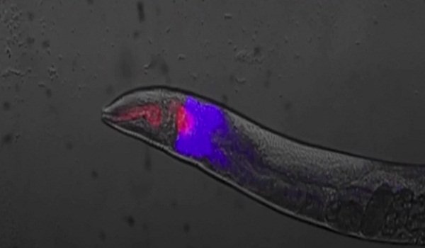بحث علمي: وفاة جسم الإنسان كالحريق الذي يشب في منزل؟