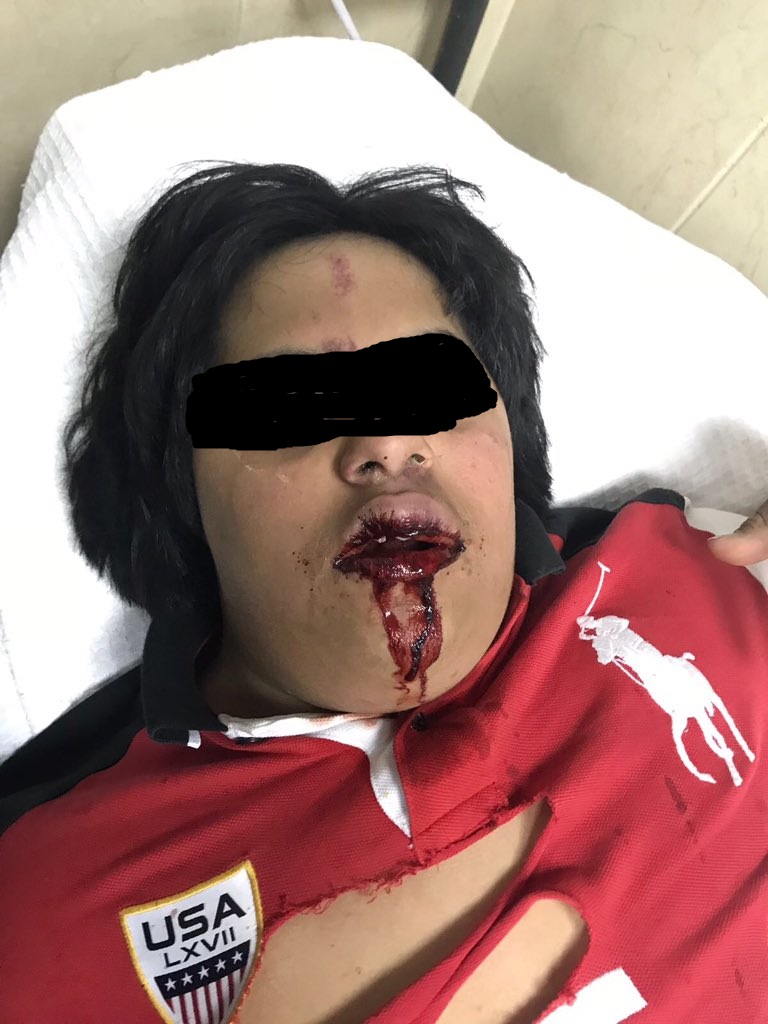 واقعة مؤسفة .. “شاب متزن” يعتدي على مريض بـ “متلازمة داون”