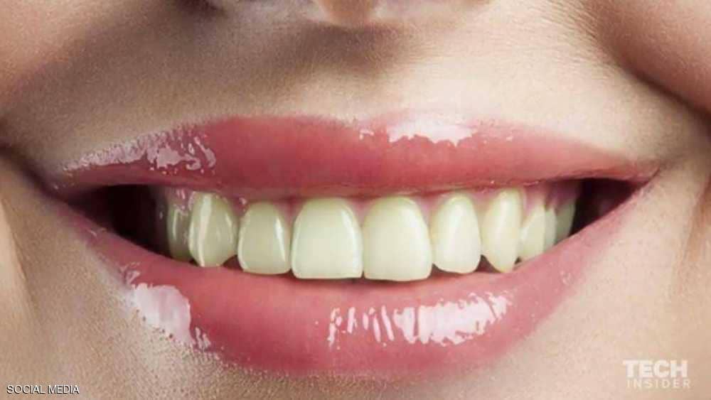 “تبييض الأسنان” خدعة هائلة.. والحل بسيط جدا