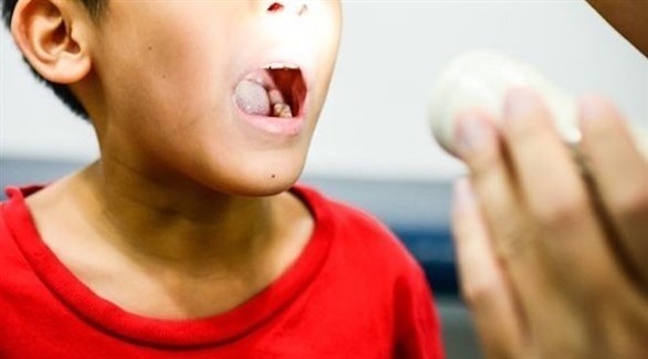 علاجات منزلية لاحتقان الحلق لدى الطفل