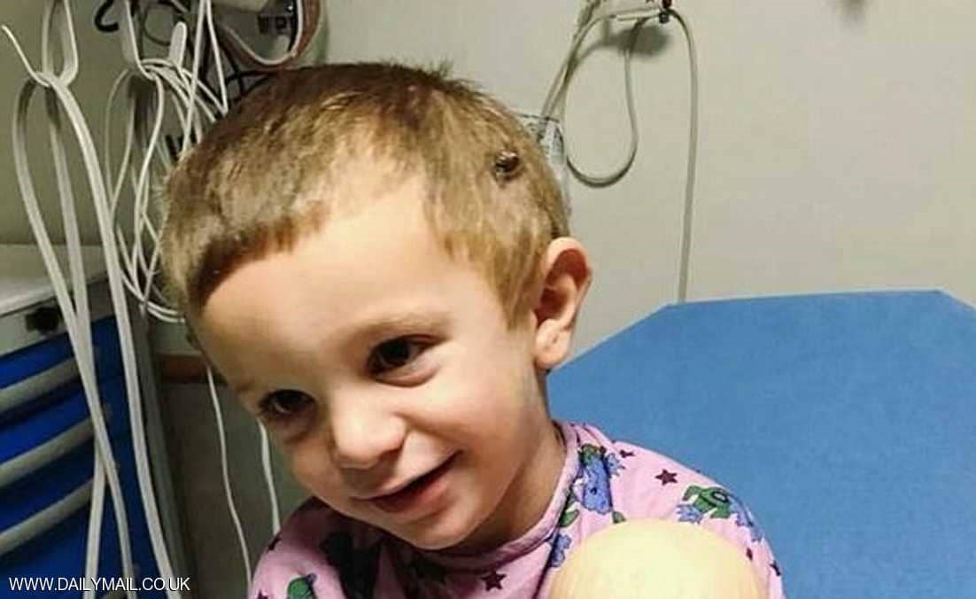 شاهد.. طفل برأس شخص بالغ