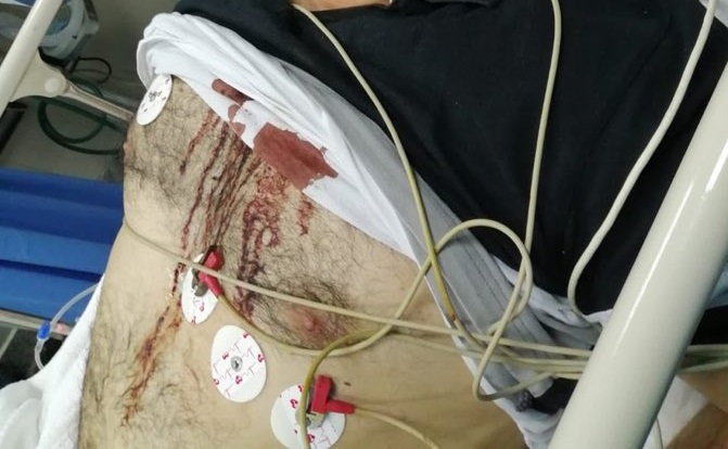 أول تعليق من الجمعية الطبية بشأن الاعتداء على طبيب العدان