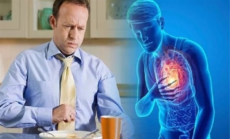 4 خطوات بسيطة تساعدك على التخلص من حرقة المعدة