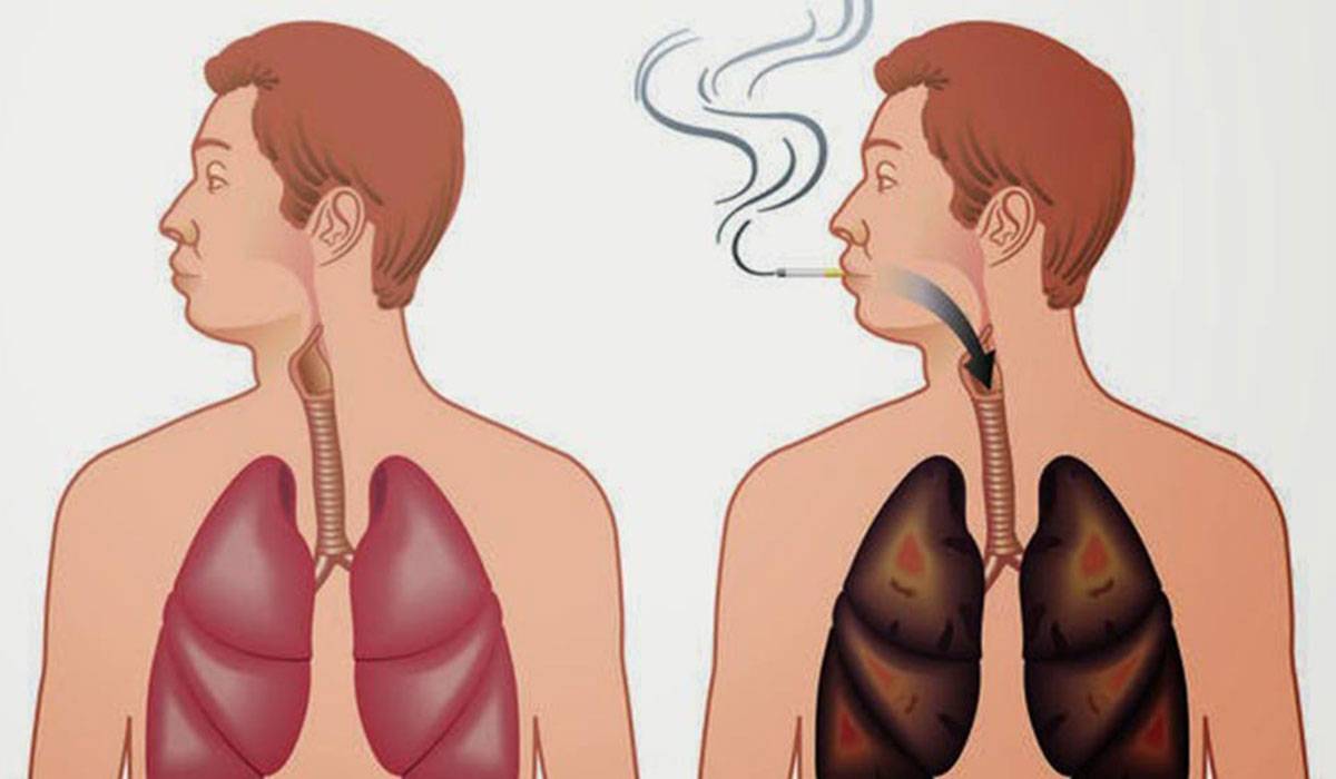 مهما كانت نتيجة الجدل حول #التدخين .. لكن لا ننصح أبدأ أي مدخن إهمال صحة رئته