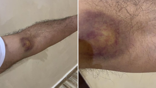 أهالي #مدينة_صباح_الأحمد: نستنشق سموم الصرف الصحي ونعاني من الحشرات الناقلة للأمراض..