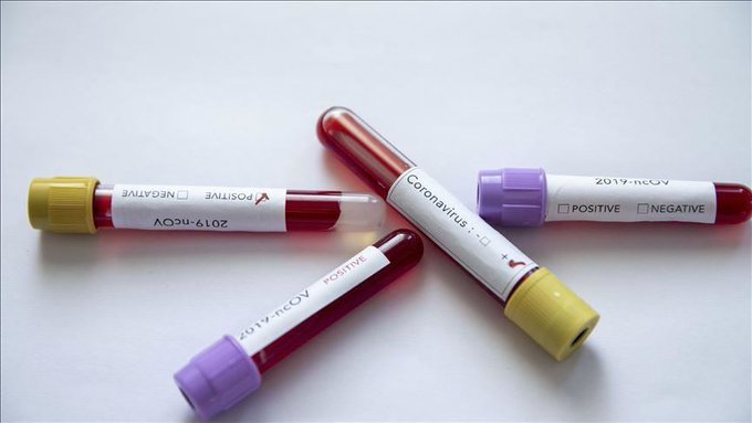 أبرز ما جاء في مؤتمر #وزارة_الصحة حول مستجدات فيروس كورونا