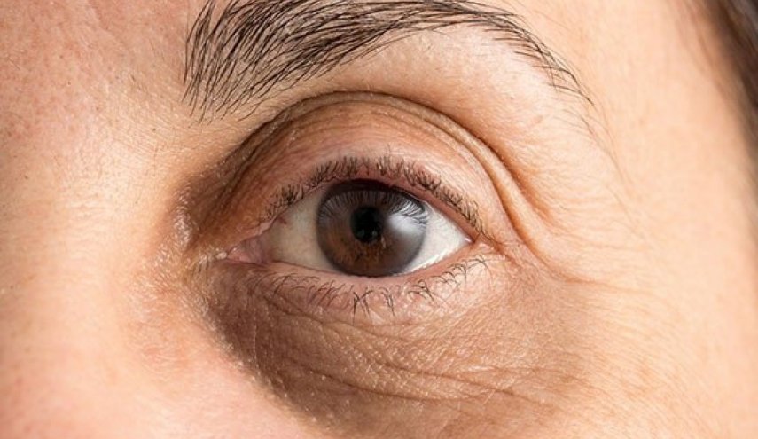 طريقة بسيطة لإخفاء الهالات السوداء تحت العين