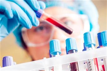 عاجل – 900 إصابة جديدة بـ #كورونا.. وارتفاع الإصابات إلى 87.378