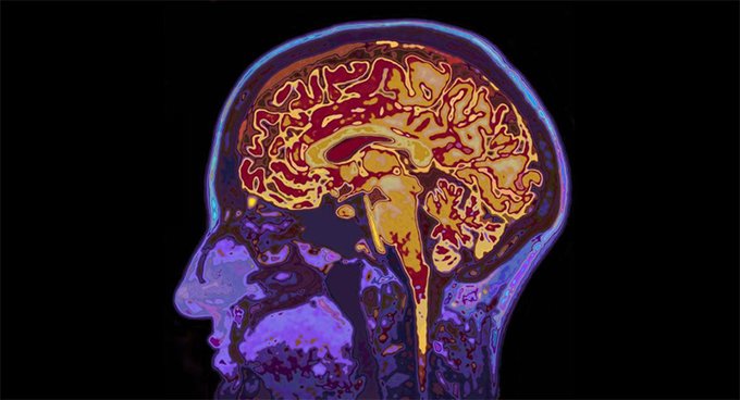 دراسة حديثة: الكافيين ومشروبات الطاقة يؤثران على بنية الدماغ