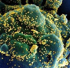 بعد تحذير منظمة الصحة.. ماذا تعرف عن المتحور «لامدا»؟