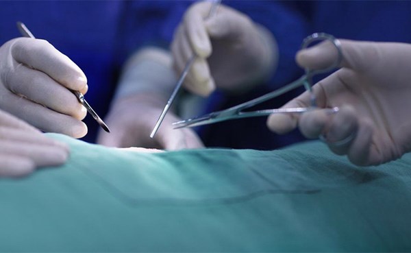 جراحة إزالة الزائدة الأذينية اليسرى تنقذ مرضى عدم انتظام ضربات القلب