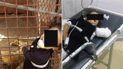 أسد يلتهم ذراع طفلة يمنية أثناء التقاط صورة تذكارية