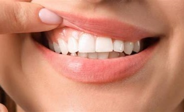 دراسة تفيد بتطوير “هلام” لعلاج أمراض اللثة من خلال محاربة الإلتهابات