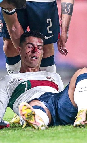 «الآزوري» لخطف بطاقة التأهل من سويسرا