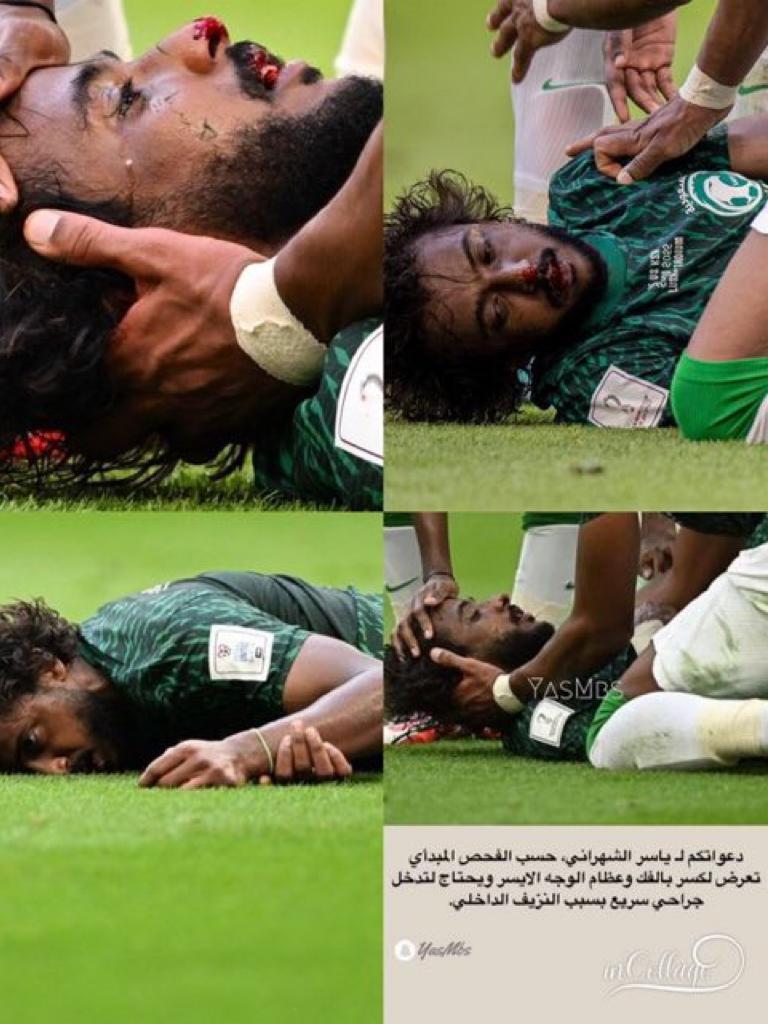 بأمر #ولي_العهد السعودي محمد بن سلمان.. طائرة خاصة تنقل اللاعب #ياسر_الشهراني إلى #ألمانيا للعلاج