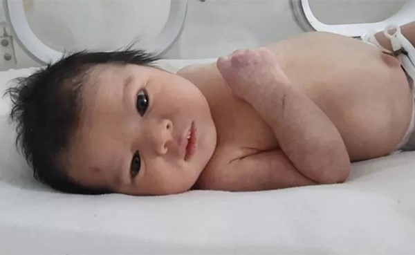 زلزال تركيا وسورية: نقل الطفلة المعجزة آية إلى «مكان آمن» خوفاً من خطفها