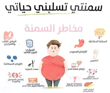 مديرة #تعزيز_الصحة: #الكويت الأولى عربياً في ارتفاع نسبة #السمنة وزيادة الوزن